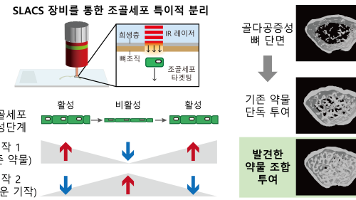 골다공증 치료 효율 높이는 새로운 메커니즘 세계 최초 발견