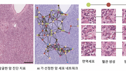AI 기술로 '암 세포 네트워크' 규명 통한 차세대 암 진단 지표 개발